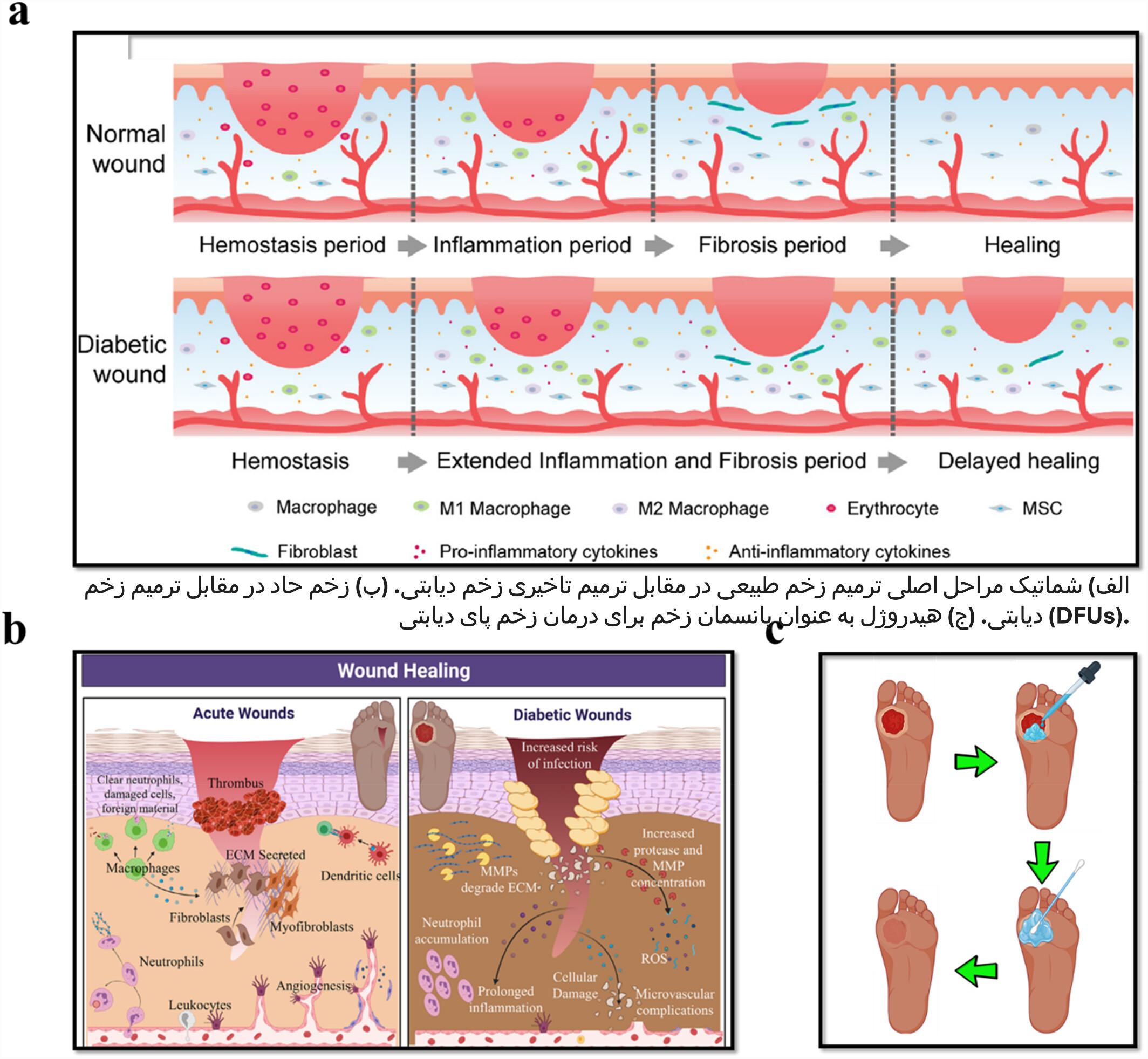 DF pathology