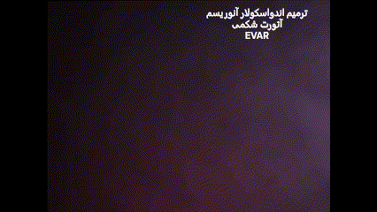 ٍEVAR gif